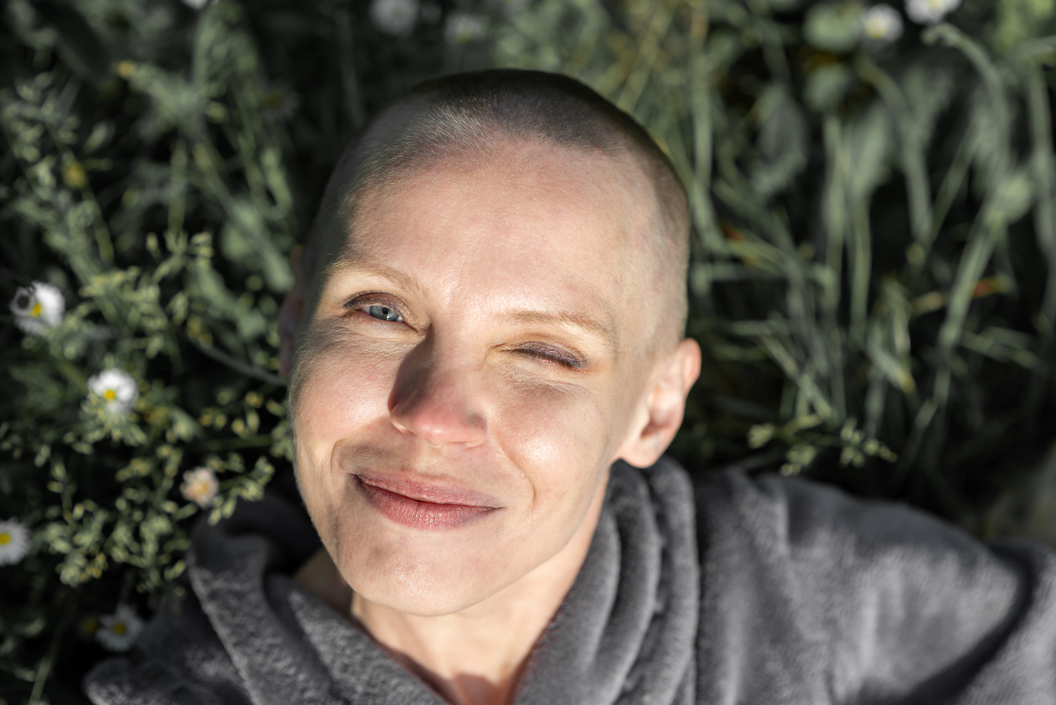 Haarausfall bei der Chemo – Tipps für Styling und Pflege